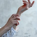 Chronic Itch