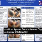 Acanthosis Nigricans