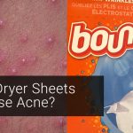 Causes of Acne