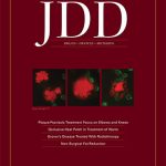 JDD