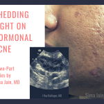 Hormonal Acne