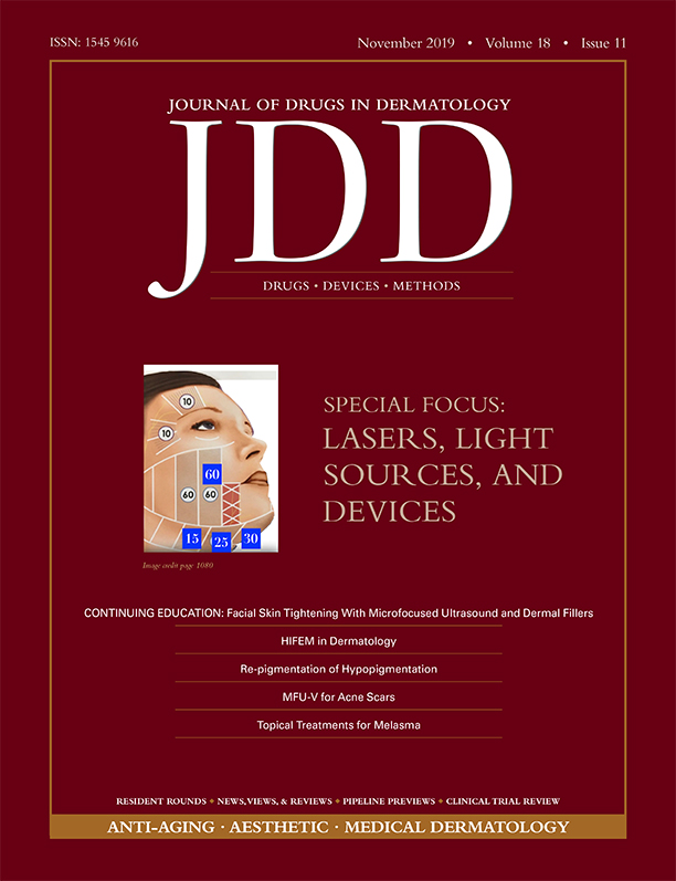 JDD November Lasers and Light Sources