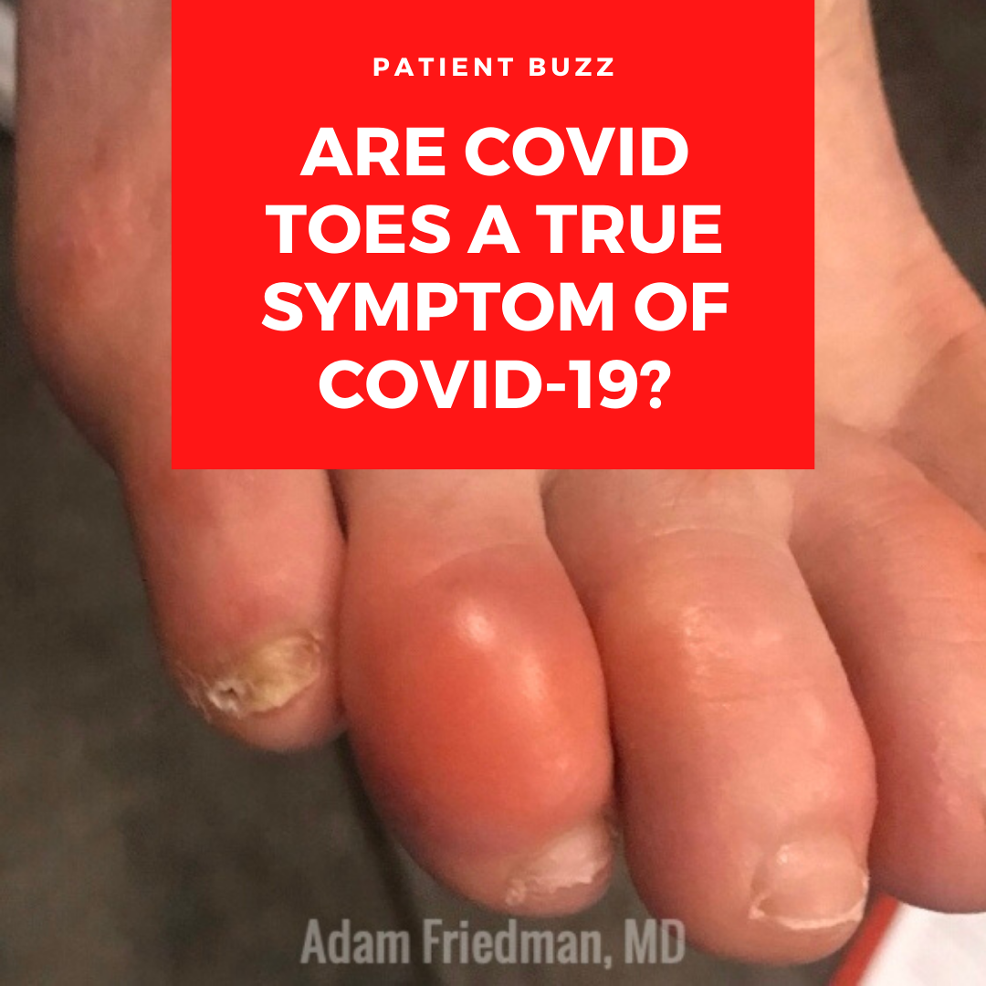 COVID Toes