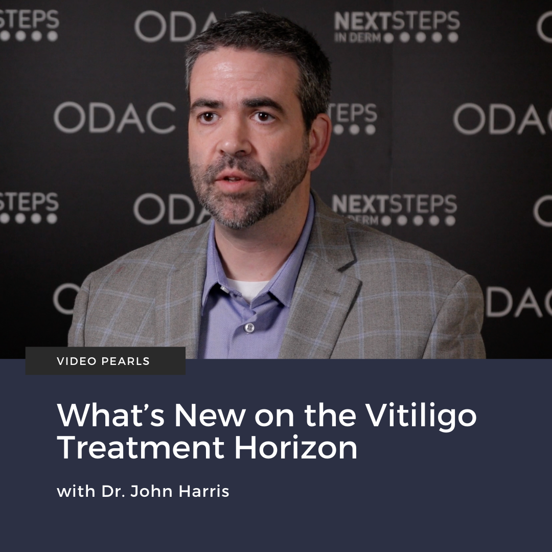 What’s New on the Vitiligo Treatment Horizon Next Steps in Dermatology