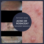 acne or papulopustular rosacea