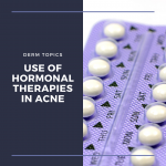 HORMONAL ACNE
