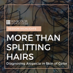 Alopecia in SOC