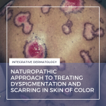 dyspigmentation