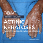 Actinic Keratoses