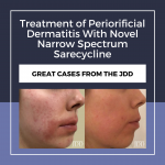 Periorificial Dermatitis
