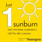 sunburn