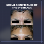 eyebrows