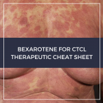 Bexarotene for CTCL