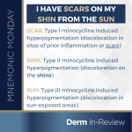 Minocycline induced hyperpigmentation