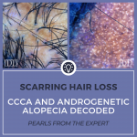 Scarring Hair Loss