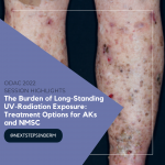 Actinic Keratoses (AKs)