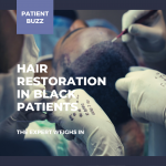 hair restoration