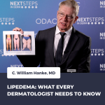 lipedema