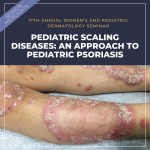 Pediatric Psoriasis