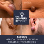 keloids