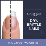 brittle nails