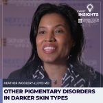 pigmentary disorders
