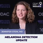 melanoma