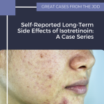 isotretinoin
