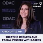 rosacea