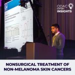 Non-melanoma skin cancer