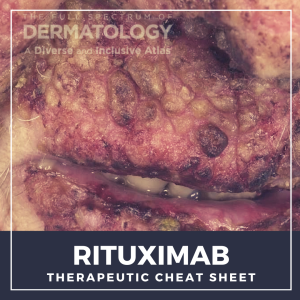 Rituximab