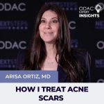 acne scars