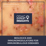 Immunobullous Diseases