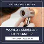 skin cancer