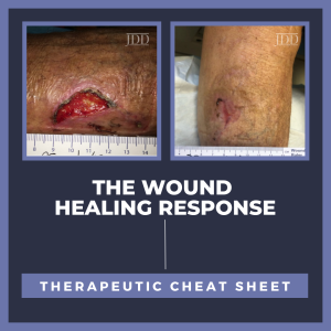 wound healing