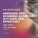 minoxidil
