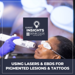 lasers